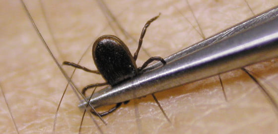 capusa scoasa din piele