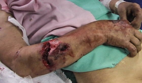 muscatura-antebrat-caine