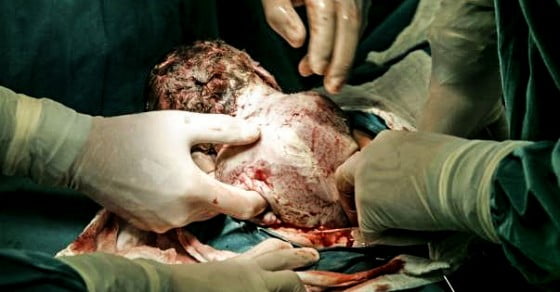 nastere_naturala_fafc5dcd1d