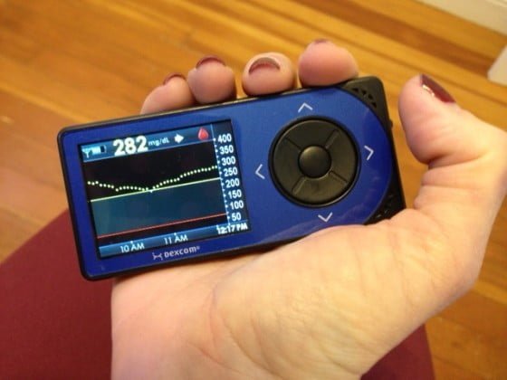 dexcom-g4-ocean-blue