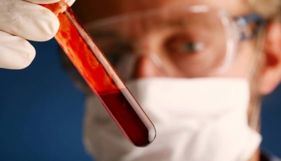 analizesangeheptafdc80c43cf-1497357838