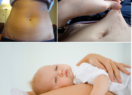 How-to-Lose-Weight-Fast-After-Pregnancy